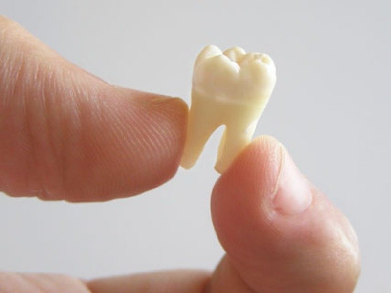 До чого сняться зуби